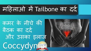 Tailbone Pain In ladiesमहिलाओ में Tailbone का दर्द [upl. by Donal]