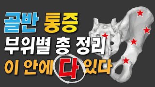 골반통증엉덩이통증 부위별로 원인과 해결법 정확히 알려드립니다 [upl. by Saravat]