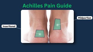 Achilles Tendinopathy  Tendinitis  Exercise  Best treatments  Recovery [upl. by Onavlis]