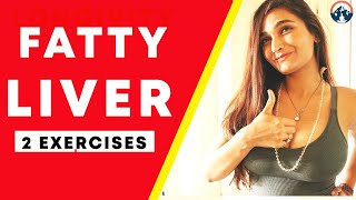 Best Exercise for Fatty Liver Disease  Keeping Liver Healthy Naturally [upl. by Aicilyhp]