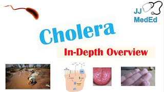 Cholera Vibrio Cholerae Pathophysiology Risk Factors Symptoms Diagnosis and Treatment [upl. by Kcirej791]