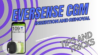 Eversense CGM Insertion and Removal Tips and Tricks [upl. by Naitsabas255]