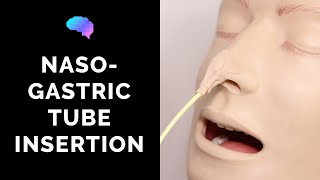 Nasogastric NG Tube Insertion  OSCE Guide  UKMLA  CPSA [upl. by Vincentia]