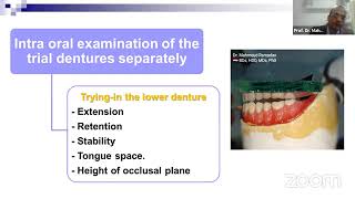 Complete denture tryin Part 3 Intraoral examination of the lower trial denture [upl. by Sierra818]