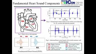 A Novel Algorithm Based on Stockwell Transform for Boundary Detection and Segmentation of Heart PCG [upl. by Korry]