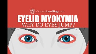 Eyelid Myokymia  Why do my eyes keep jumping [upl. by Naval]