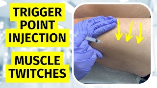 Trigger Point Injection Twitches  Dry Needling Twitch Response [upl. by Abran]