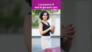 Chickenpox से ऐसे करें खुद का बचाव देखें वीडियो shorts smallpox chickenpox [upl. by Forward]