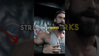 Prevent Stretch Marks Easily 4 steps ✍️ fitness bodybuilding gym bulk shorts stretchmarks [upl. by Zackariah817]