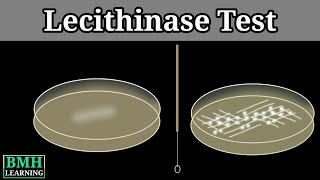 Lecithinase Test  Naglers Reaction  Clostridium Testing Method  Test For Clostridium Perfirenges [upl. by Akinit]