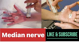 MEDIAN NERVE NERVE CONDUCTION STUDY  NCS  NCV emg ncs ncv neuroscience [upl. by Nivalc]