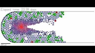 Ductal carcinoma in situ DCIS simulation [upl. by Morse]