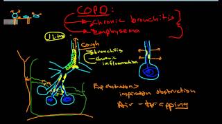 Pathophysiology of COPD [upl. by Nilra]