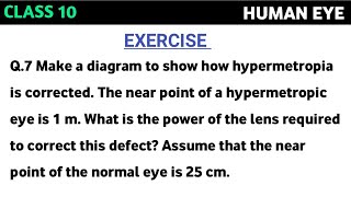 Make a diagram to show how hypermetropia is corrected The near point of a hypermetropic eye is 1 m [upl. by Rollins414]