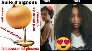 Comment faire lhuile doignons contre la chute de cheveux cheveux cassants fins pellicule😱😲 [upl. by Robet]