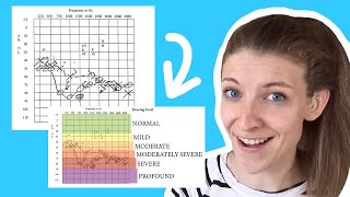 How to Read an Audiogram [upl. by Odicalp]