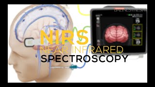 Nearinfrared Spectroscopy using INVOS [upl. by Damon]