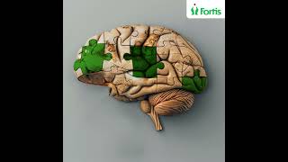 Discover the Revolutionary Gamma Knife for Brain Tumour Treatment at Fortis Hospital Gurugram [upl. by Aciemaj355]