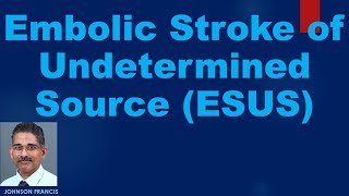 Embolic Stroke of Undetermined Source ESUS [upl. by Alimrahs]