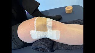 Knee  Patella Taping [upl. by Tab]