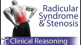 Lumbar Radicular Syndrome vs Intermittent Neurogenic ClaudicationStenosis [upl. by Llain913]