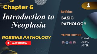 Introduction to Neoplasia  Neoplasia Lectures Chapter 6 Robbins Basic Pathology Lecture 1 [upl. by Lorollas468]