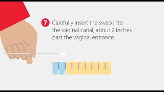 How to Collect a Vaginal Swab Sample  StepbyStep Guide [upl. by Koenraad]