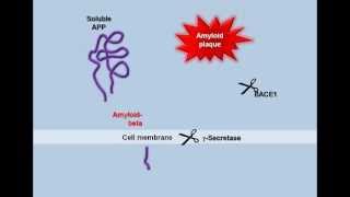 Plaque Formation in the Alzheimers Brain [upl. by Landers]