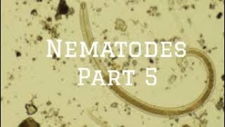 Intestinal Nematodes Trichinella microbiology nematode [upl. by Eseyt]