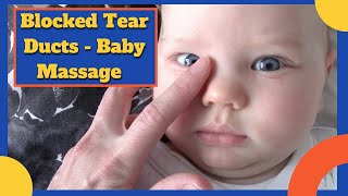 BABY BLOCKED TEAR DUCTS  Including massage video [upl. by Nuahsel]