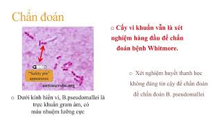 Bệnh Whitmore  Melioidosis  Burkholderia pseudomallei [upl. by Anerul]