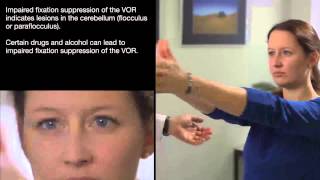 Visual Fixation Suppression of the VOR [upl. by Llenol]