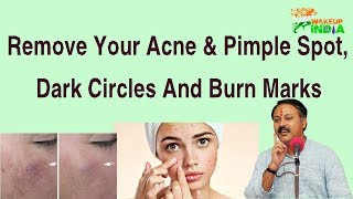 Remove your acne pimple spot dark circles and burn marks  Rajiv Dixit [upl. by Lartnom]