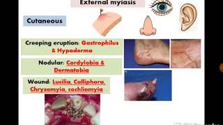 Flies amp Myiasis dr noha madbouly [upl. by Nairot700]