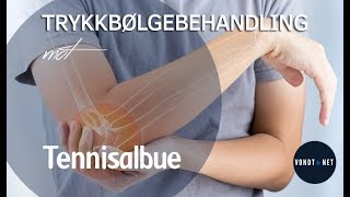 Trykkbølgebehandling mot Tennisalbue Lateral epikondylitt [upl. by Gemoets241]