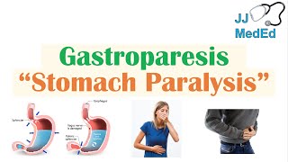 Gastroparesis Stomach Paralysis  Causes and Risk Factors Signs amp Symptoms Diagnosis Treatment [upl. by Adelaja998]