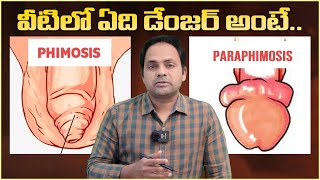 అంగంపై చర్మం ఇలా అయితే  Symptoms of Phimosis and Paraphimosis  Dr Sridhar Reddy  Vikram TV Health [upl. by Wiles]