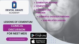 Clinical Discussions Lesions of cementum amp related lesions For NEET MDS [upl. by Esilenna456]