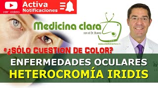 Heterocromía iridis Ojos de cada color ¿Qué enfermedad puede ocultar  MedicinaClara [upl. by Nyrb]