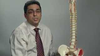 Degenerative changes of the spine  Ohio State Medical Center [upl. by Hebrew]