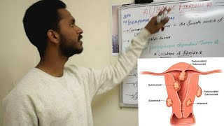 UTERINE FIBROID  SHORT REVIEW  MEDDY SIMPLIFIED  OBG [upl. by Karla]