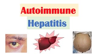 Autoimmune Hepatitis  Pathogenesis Signs amp Symptoms Diagnosis Treatment [upl. by Davison439]