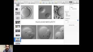 OOCYTE QUALITY ASSESSMENT [upl. by Airad91]