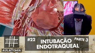 AULATOMIA 22  Intubação Endotraqueal 33 [upl. by Anette]