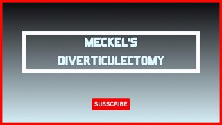 ETC 004 Laparoscopic Meckels Diverticulectomy [upl. by Nnylatsyrc]