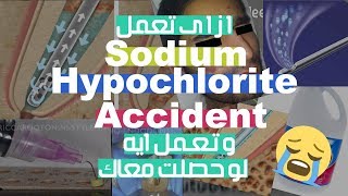 How To Avoid and How To Manage Sodium Hypochlorite Accident [upl. by Alo]