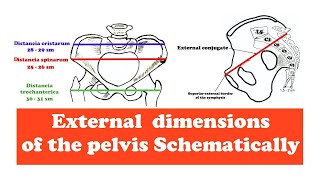 External dimensions of the pelvis [upl. by Yentterb831]