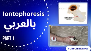 Iontophoresis بالعربي [upl. by Meehan604]