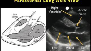 Echocardiography course Part 1 Parasternal Long Axis [upl. by Aneladgam]