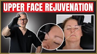 Upper Face Injection techniques  Botox amp Filler Periorbital Rejuvenation Tutorial [upl. by Ekim]